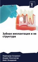 Зубная имплантация и ее структура