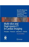 Multi-Slice and Dual-Source CT in Cardiac Imaging: Principles - Protocols - Indications - Outlook
