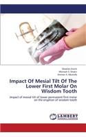 Impact of Mesial Tilt of the Lower First Molar on Wisdom Tooth