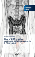 Role of MMR in colon carcinoma cells in response to 5-Fluorouracil