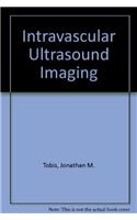 Intravascular Ultrasound Imaging