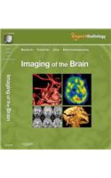 Imaging of the Brain: Expert Radiology Series