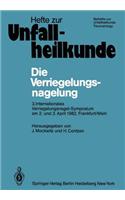 Die Verriegelungsnagelung