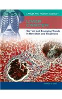 Liver Cancer