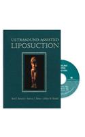 Ultrasound-Assisted Liposuction
