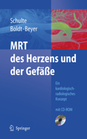 Mrt Des Herzens Und Der Gefäße