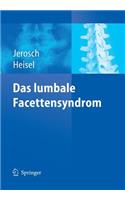 Das Lumbale Facettensyndrom