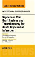 Saphenous Vein Graft Lesions and Thrombectomy for Acute Myocardial Infarction, an Issue of Interventional Cardiology Clinics