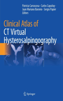 Clinical Atlas of CT Virtual Hysterosalpingography