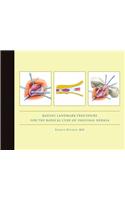 Bassini Landmark Procedure for the Radical Cure of Inguinal Hernia