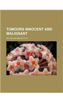 Tumours Innocent and Malignant