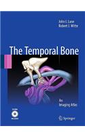 Temporal Bone