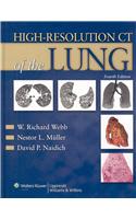 High-Resolution CT of the Lung [With Online Access Code]