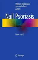 Nail Psoriasis: From A to Z