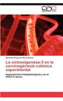 Ciclooxigenasa-2 En La Carcinogenesis Colonica Experimental