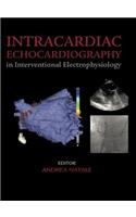 Intracardiac Echocardiography in Interventional Electrophysiology