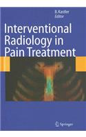 Interventional Radiology in Pain Treatment