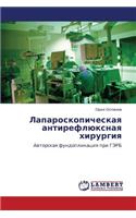 Laparoskopicheskaya Antireflyuksnaya Khirurgiya
