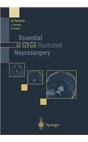 Essential Illustrated Neurosurgery
