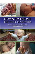 Down Syndrome: The First 18 Months: The First 18 Months