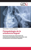 Fisiopatología de la ortodoncia lingual