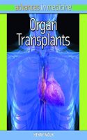 Organ Transplants: (Advances in Medicine)