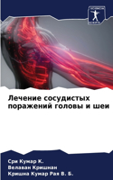 Лечение сосудистых поражений головы и ше&#1080
