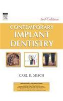 Contemporary Implant Dentistry