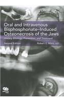 Oral and Intravenous Bisphosphonate-Induced Osteonecrosis of the Jaws: History, Etiology, Prevention, and Treatment