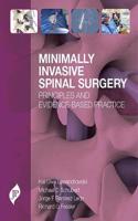 Minimally Invasive Spinal Surgery