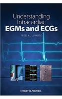 Understanding Intracardiac EGMs and ECGs