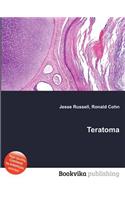 Teratoma