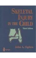 Skeletal Injury in the Child