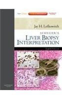 Scheuer's Liver Biopsy Interpretation