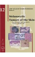 Melanocytic Tumors of the Skin