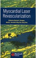 Myocardial Laser Revascularization