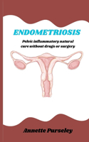 Endometriosis: Pelvic Inflammatory Natural Cure Without Drugs or Surgery