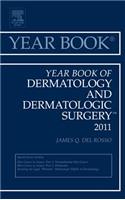 Year Book of Dermatology and Dermatological Surgery 2011