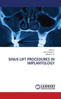 Sinus Lift Procedures in Implantology