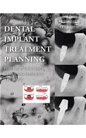 Dental Implant Treatment Planning for New Dentists Starting Implant Therapy