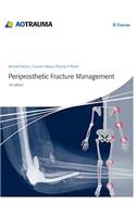 Periprosthetic Fracture Management