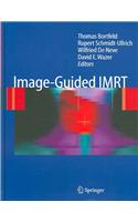 Image Guided IMRT