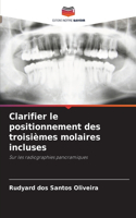 Clarifier le positionnement des troisièmes molaires incluses