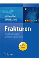 Frakturen