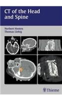 CT of the Head and Spine