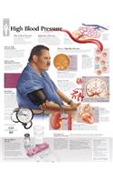 High Blood Pressure Chart