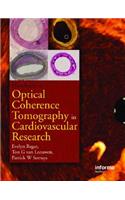 Optical Coherence Tomography in Cardiovascular Research