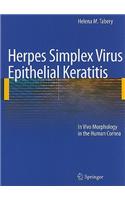 Herpes Simplex Virus Epithelial Keratitis