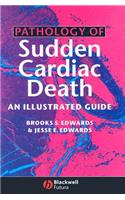 Pathology of Sudden Cardiac Death