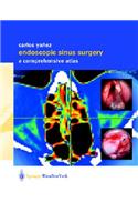 Endoscopic Sinus Surgery